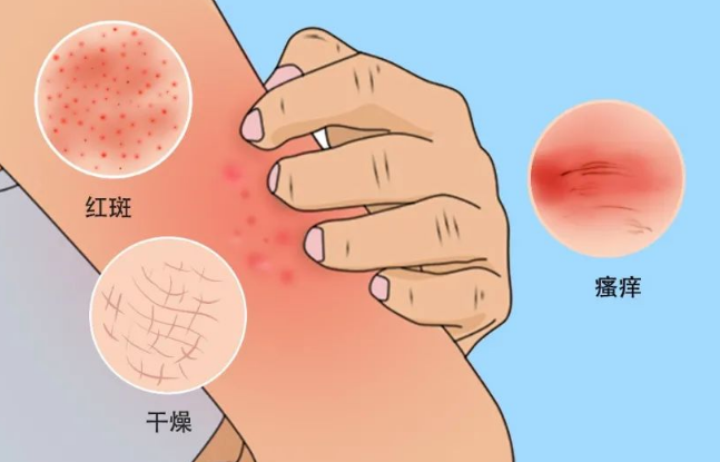 青岛皮肤研究院怎么样[名次前列]-皮炎是什么原因引起的